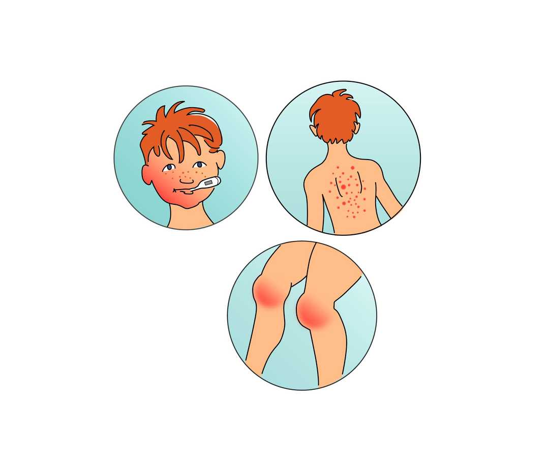 Tims Symptome Tims Symptome