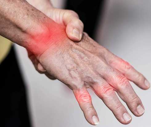 Rot gekennzeichnete Gelenke an einer Hand Rot gekennzeichnete Gelenke an einer Hand